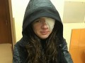 Руслана перенесла серйозну операцію на обличчі